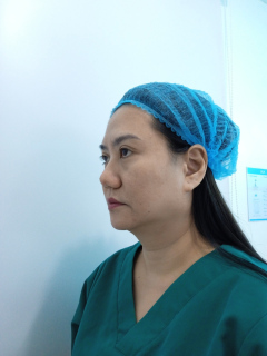 Threadlift
